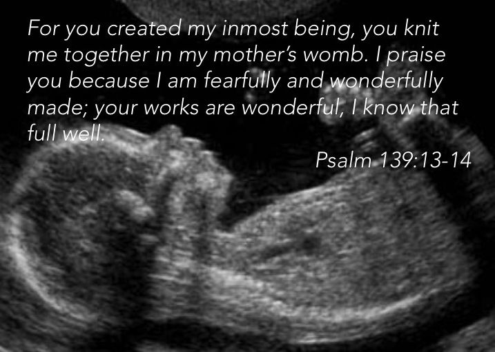 Jesus - you knit me in my mothers womb