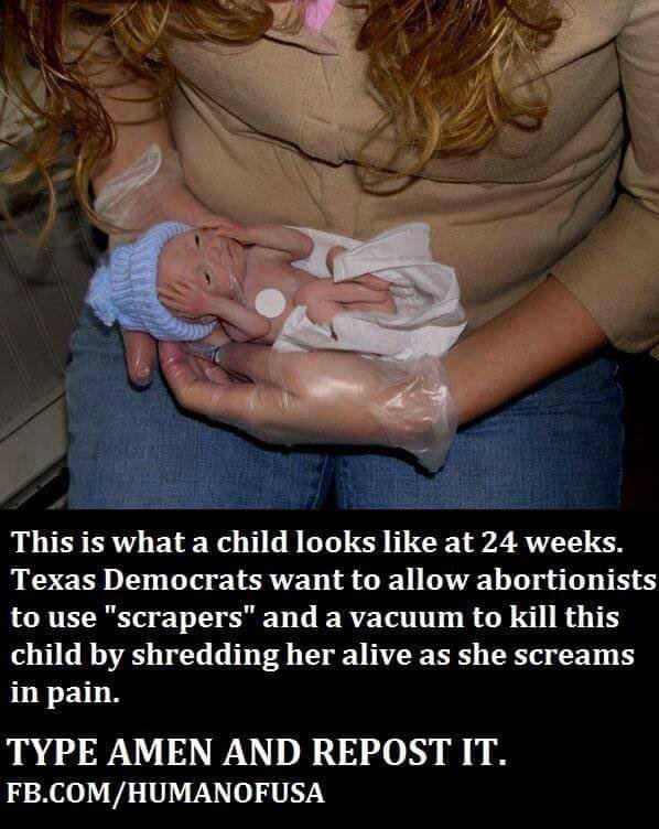 abortion - lady holding 24 wk baby in arms incredible